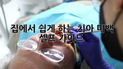 집에서 쉽게 하는 치아 미백 셀프 가이드 ✨